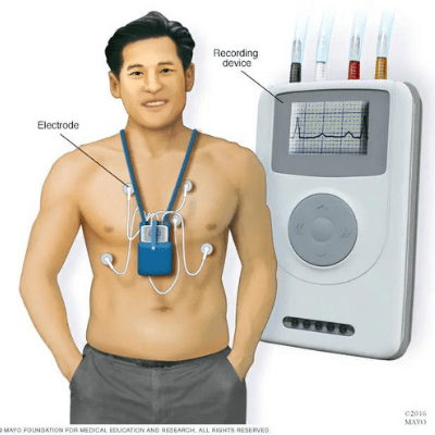 Image of an Holter monitor