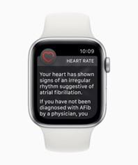 Do Smart Watches Work in Detecting Irregular Heart Rhythms? 2