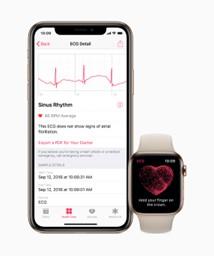 Do Smart Watches Work in Detecting Irregular Heart Rhythms? 3